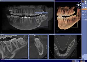 röntgenbild-dvt-6905db94 Röntgenbild
